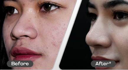 Our result for Face Peel Off